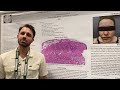 A Consult in the Burn ICU: Toxic Epiderman Necrolysis vs Acute Cutaneous Lupus Erythematosus
