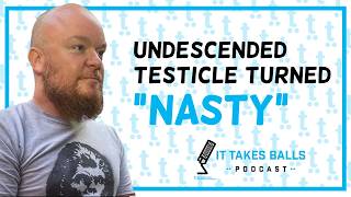 James Paul's Undescended Testicle Turned Nasty in his 40s