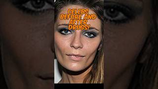 Celebs Before and after Drug Addiction