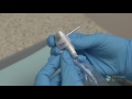 RINN Uni-Grip 360 Assembly | Dentsply Sirona