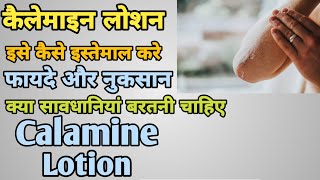 कैलेमाइन लोशन क्या होता है, फायदे और नुकसान || Calamine lotion in Hindi || MedHealth Support