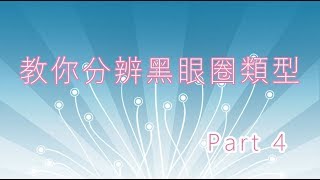 教你分辨/解決黑眼圈類 (青藍色原理+食療)