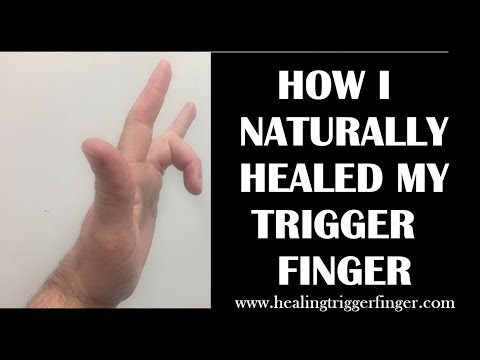 How I Healed My Trigger Finger Naturally How I Healed My Trigger Finger Naturally