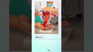 Advanced Hysteroscopy at Southern Gem Hospital: Minimally Invasive Care for Women's Health