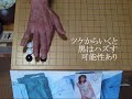 呉清源推奨 『この手ご用心』④　mr囲碁1754 b