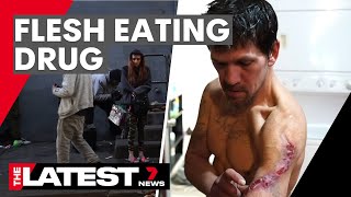 The flesh-eating drug taking over America | 7NEWS
