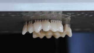 DentaFab Platform - Temporary Teeth 3D Printing in 12 Minutes
