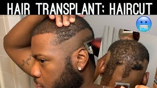 6 Month Hair Transplant Journey DHI - FUE | Before and After Haircut Tutorial | Monday Motivation