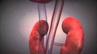 OHSU's Dr. Al Starr comments on the Sapien Transcatheter Aortic Valve