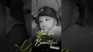 You Are Beautiful Baby 🍼😙😘#shorts #viral #trending #viralvideo #baby