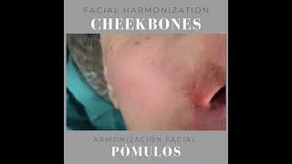 Harmonize your cheekbones: How to soften or enhance them. - Pómulos: Realzalos o suavizalos.