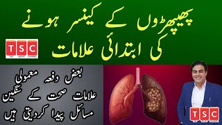 Initial symptoms of Lungs cancer | Phephro kay cancer ki alamaat by Adeel mansoor Urdu |Hindi