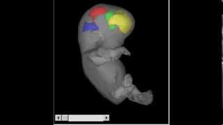 Embryo 3D ultrasound 2/2