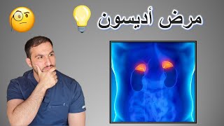 مرض أديسون   بالمختصر المفيد