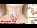 how to reduced thyroid at home. എങ്ങനെ വിട്ടിൽ തന്നെ ഉള്ളവ വച്ചു തൈറോയ്ഡ് കുറാകാം....