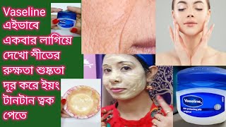 Vaseline এইভাবে একবার লাগিয়ে নাও শীতের রুক্ষতা শুষ্কতা দূর করে ইয়ং টানটান ত্বক পেতে