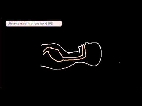 Lifestyle modifications for GERD Lifestyle modifications for GERD