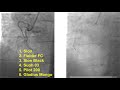 case 76 pci manual wiring challenges