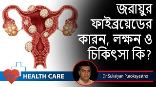 Treating Uterine Fibroid Without Surgery || জরায়ুর ফাইব্রয়েডের লক্ষণ  || Dr. Sukalyan Purkayastha