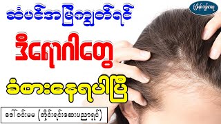 ဆံပင်အမြဲကျွတ်ရင်ဒီရောဂါတွေ ခံစားနေရပါပြီhair loss