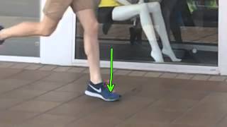 Sesamoiditis and forefoot striking run technique analysis by Brisbane Podiatrist