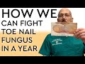 How We Can Fight Toe Nail Fungus in a Year