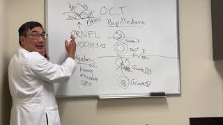 OCT in papilledema