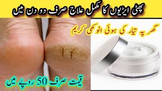 Remove Cracked Heels And Get Beautiful Feet | Home Remedy To Remove Cracked Heels.