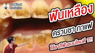 ฟันเหลือง คราบชา กาแฟ ใช้ฟันยาสีฟันแบบไหนดี แบบไหนเหมาะกับเรา ?!! | คลายปัญหารากฟันเทียมกับหมอโชค