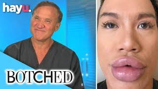 Jonathan Regrets Getting Fuller Lips After Ignoring Doctors Advice | Season 6 | Botched