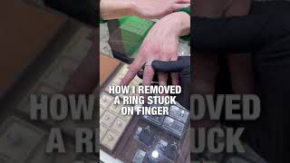 How to Remove a Ring Stuck on Finger #shorts