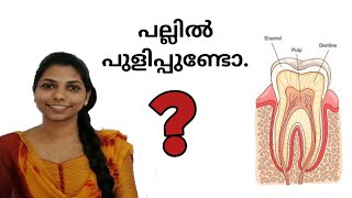 പല്ലിൽ പുളിപ്പ് ഉണ്ടോ ? അത് എങ്ങനെ പരിഹരിക്കാം ! | how tooth sensitivity occurs and its remedies