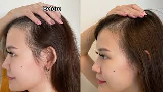 Hair Loss Remedy At Home: Why You Need The PHS HAIRSCIENCE FEM Fortify Range | CLOZETTE