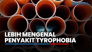 Jika Berani Lihat Gambar gambar Ini, Berarti Kamu Tak Mengidap Penyakit Trypophobia