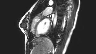 Heart MRI with sound