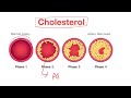 how to read tc test total cholesterol blood test report hdl ldl dr santosh singh episode 28