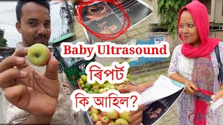 First Ultrasound in Pregnancy..ভয়ে ভয়ে ৰিপৰ্ট চালোঁ🙄।। Assamese couple vlog