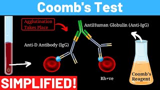 Indirect and direct Antiglobulin test (Coombs test - direct and indirect) | Panmedicad