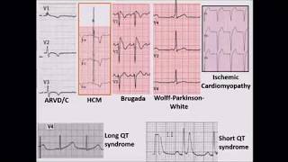 Cardiac syncope in 2018: Not for the "faint" of heart