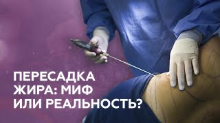 Как перекачка жира полностью меняет тело? | Липоскульптурирование | Сила пластики 18+