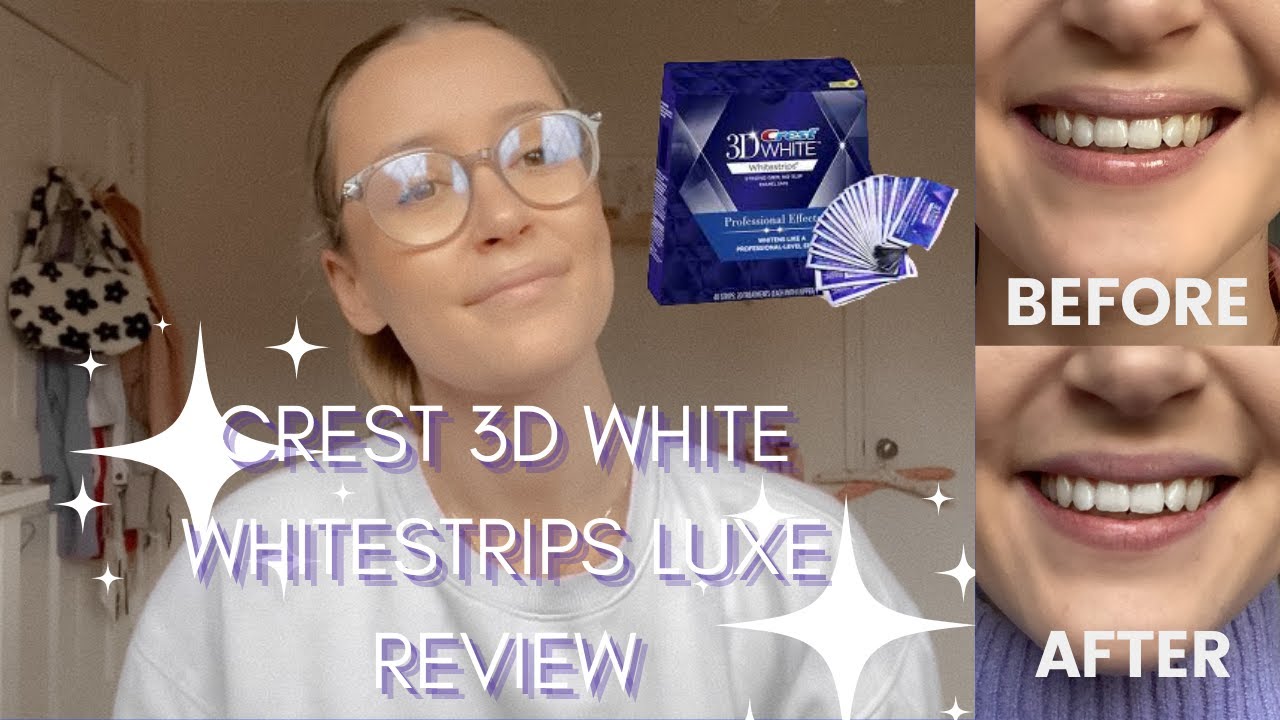 Crest Teeth Whitening Strips Before And After