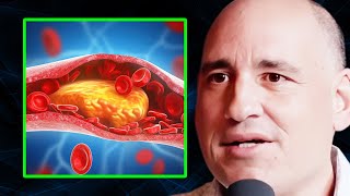 Heart Surgeon: You’ve Been LIED TO About Cholesterol & Heart Disease | Dr. Philip Ovadia