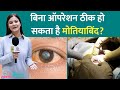 Cataract यानी सफ़ेद मोतियाबिंद के इलाज में देरी यानी अंधापन, डॉ. से जानिए क्या करें  | Eye Health