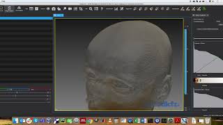 MPHY0026: Mixed Surface and Volume Rendering