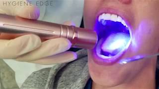 Oral ID-An oral cancer screening device