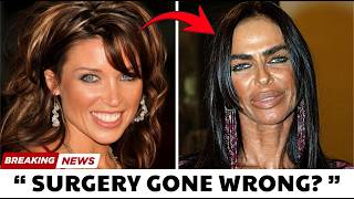 18 Celebrities Who Completely Ruined Their Faces With Plastic Surgery | Then And Now 2026