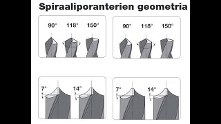 Poranterän kunnostus