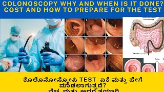 COLONOSCOPY WHY IS IT DONE?COMPLICATIONS,COST,PREPARATION OF COLON  AND REPORT EXPLAINED IN KANNADA