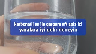 aft nasıl geçer ne iyi gelir?karbonatla yapılan gargara ile ağız içi yaralardan kurtulun.