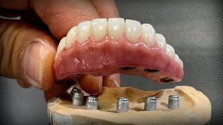 Making a Removable Zirconia Restoration with Locators®